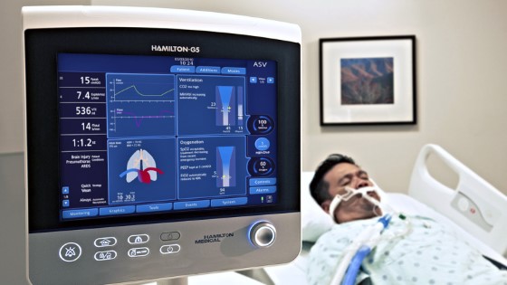 Umělá plicní ventilace je jedna z nějačstějších forem léčby ARDS a jiných akutních respiračních onemocnění, jakým je v současnosti i covid-19